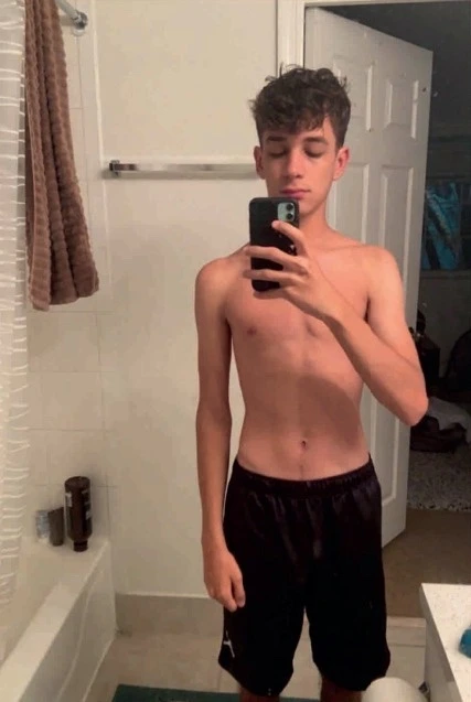 Enzo, antes do acompanhamento